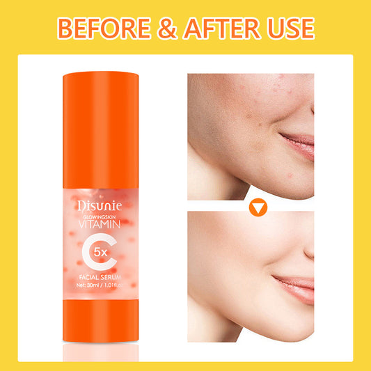 Luniva Care USA anti-aging serum with collagen and hyaluronic acid showing before and after facial skin improvement