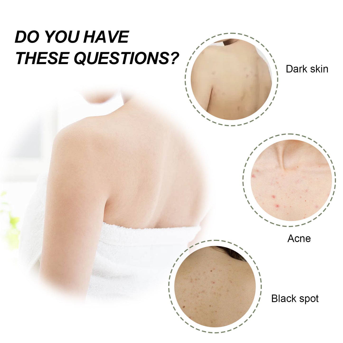 Woman's back showing skin issues with dark skin, acne, and black spots needing moisturizing shower oil for dry skin