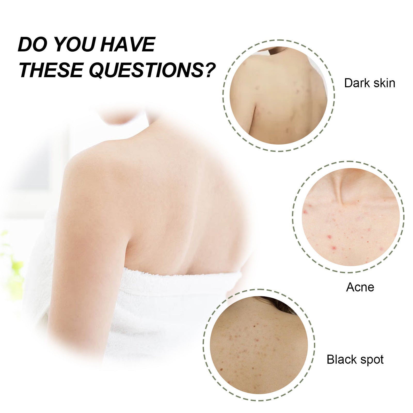 Woman's back showing skin issues with dark skin, acne, and black spots needing moisturizing shower oil for dry skin
