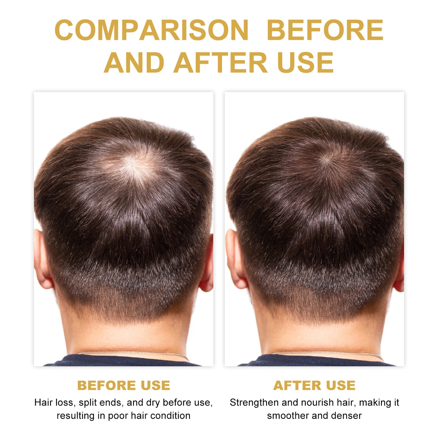 Before and after comparison of hair showing improved thickness using scalp repair serum for hair loss by LUNIVA CARE USA