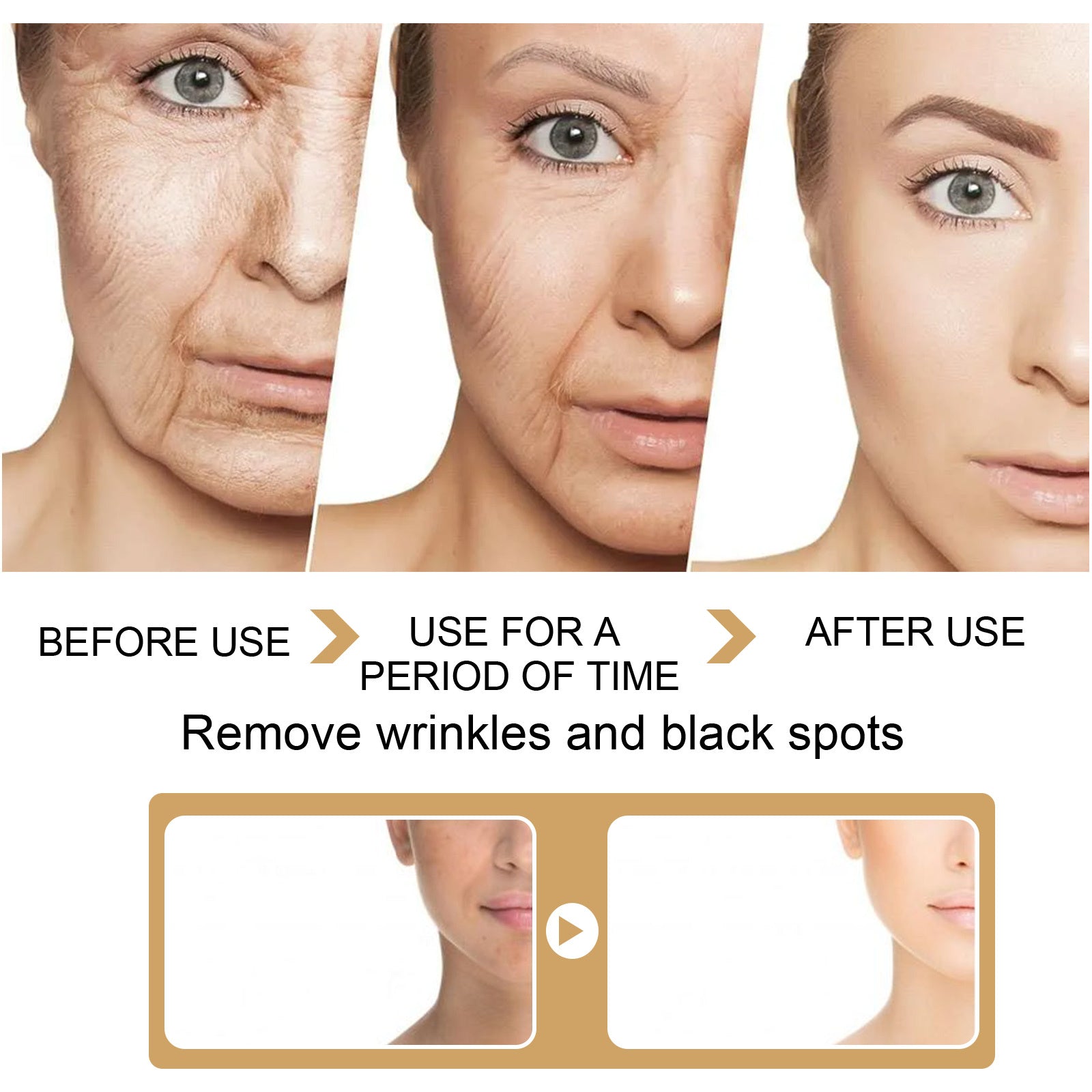 LUNIVA CARE USA turmeric serum for dark spots and acne scars showing skin improvement before and after use