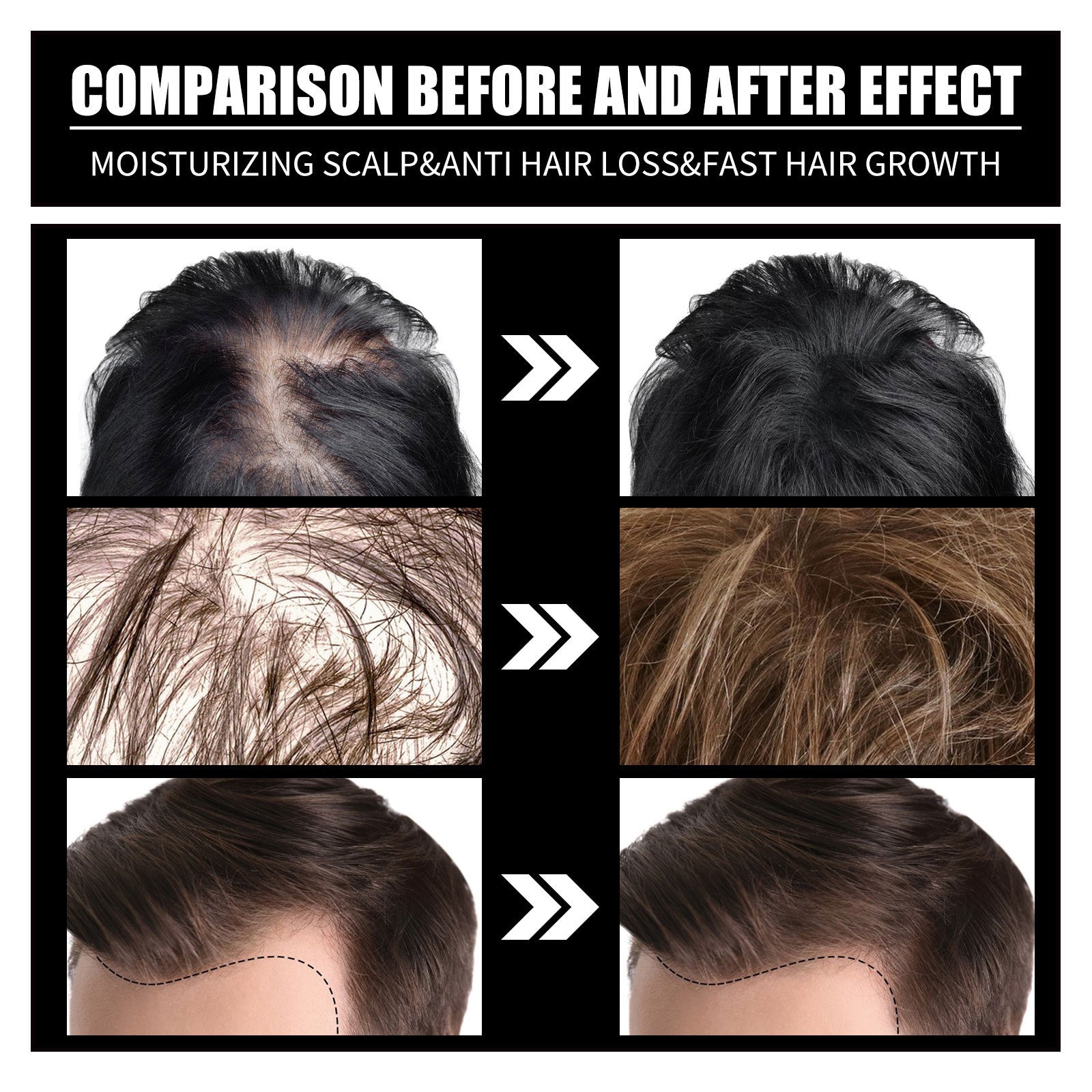 Before and after images showing hair growth results using the best collagen supplement for hair loss