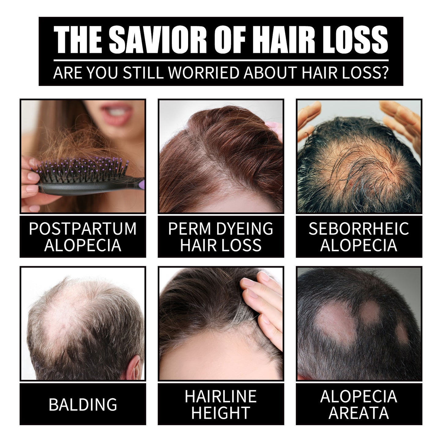 Luniva Care USA infographic showing hair loss types highlighting the best collagen supplement for hair loss