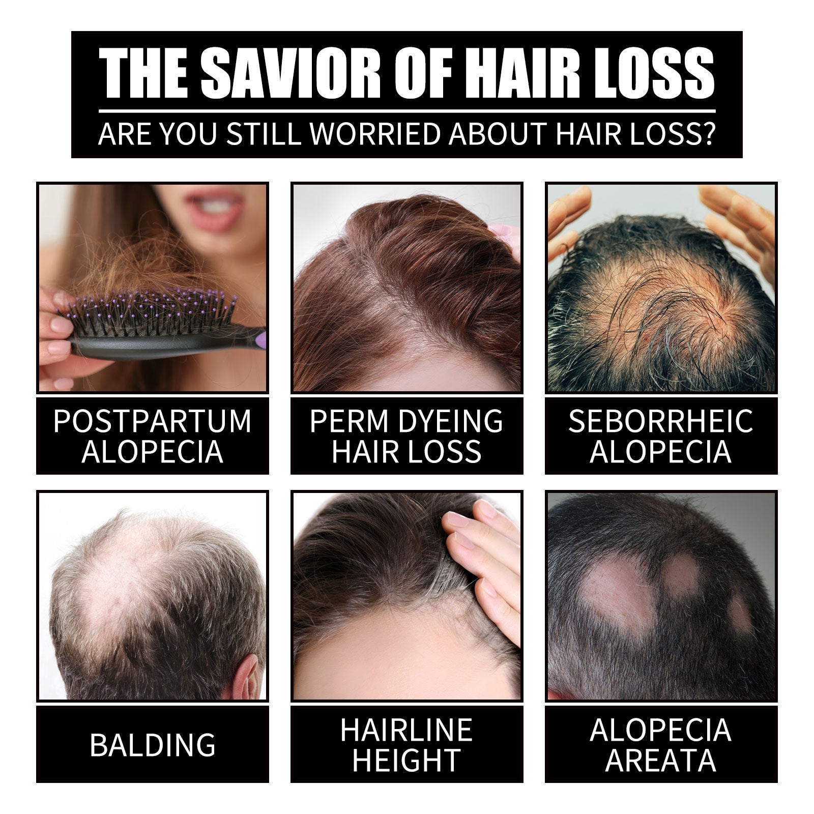 Luniva Care USA infographic showing hair loss types highlighting the best collagen supplement for hair loss