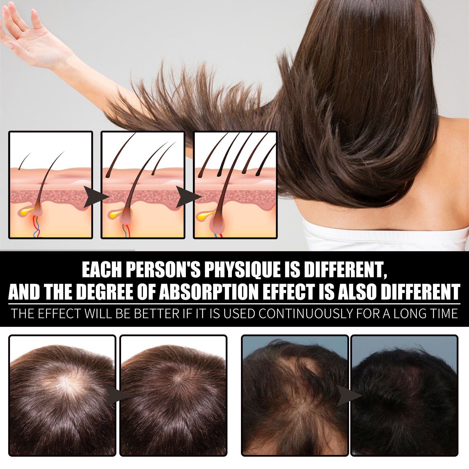 LUNIVA CARE USA best collagen supplement for hair loss showing hair follicle improvement before and after usage