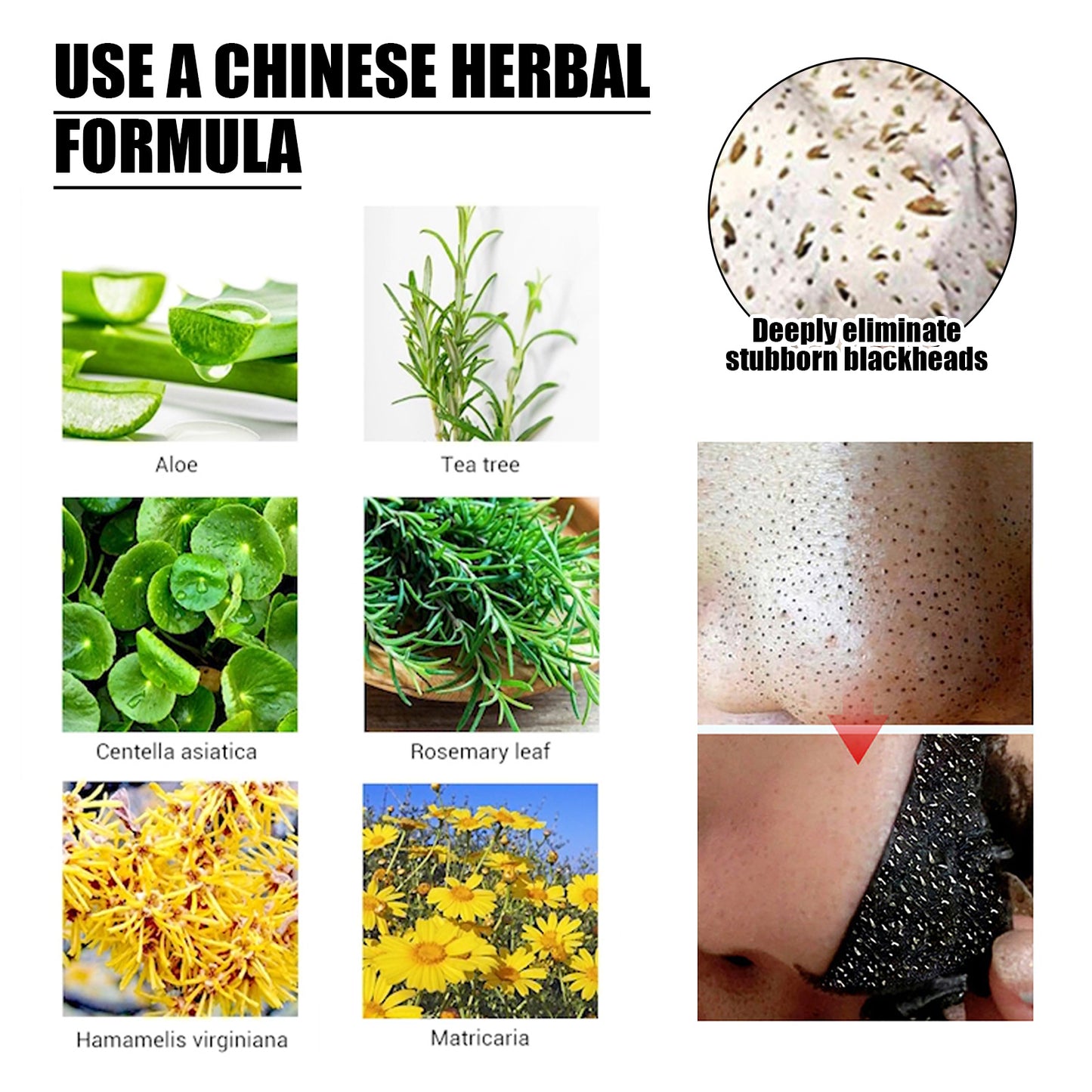 LUNIVA CARE USA blackhead removal mask for oily skin with Chinese herbal formula and natural ingredients